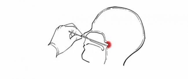 不用捅鼻子了！加拿大卫生部批准新冠检测新方法